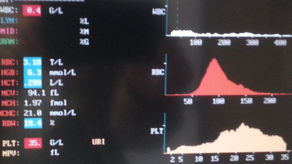 Blutanalyse: Kaum Leukozythen, Granulozyten nicht messbar, zu wenige Thrombozyten